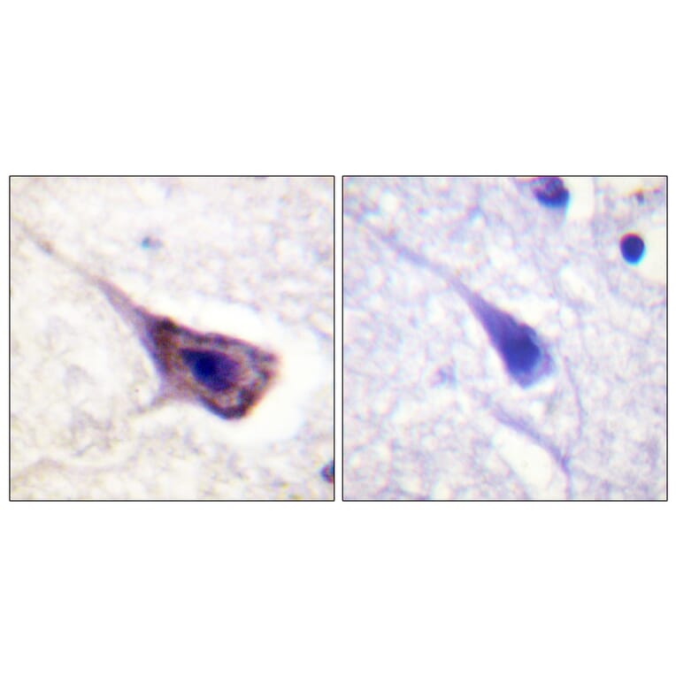 Immunohistochemistry - Anti-BAD Antibody (B0822) - Antibodies.com