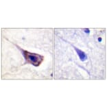 Immunohistochemistry - Anti-BAD Antibody (B0822) - Antibodies.com