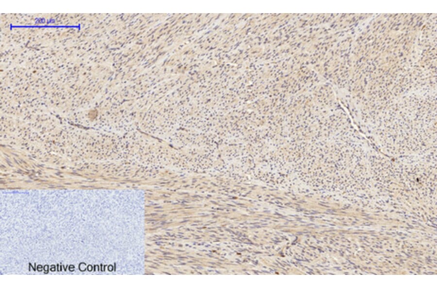 Immunohistochemistry - Anti-BAD Antibody (B0822) - Antibodies.com