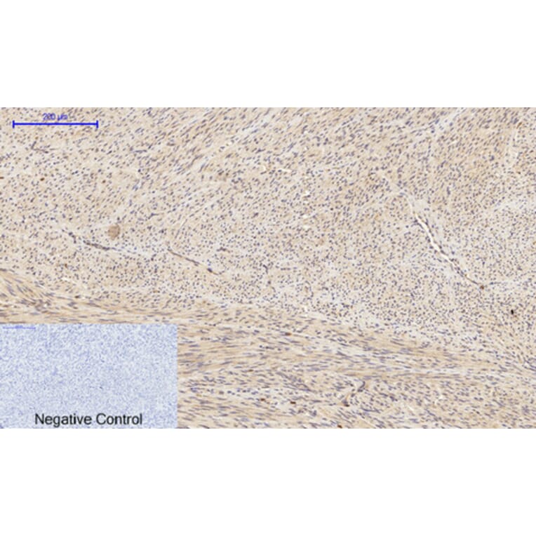 Immunohistochemistry - Anti-BAD Antibody (B0822) - Antibodies.com