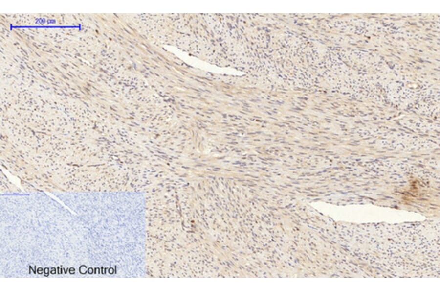 Immunohistochemistry - Anti-BAD Antibody (B0822) - Antibodies.com