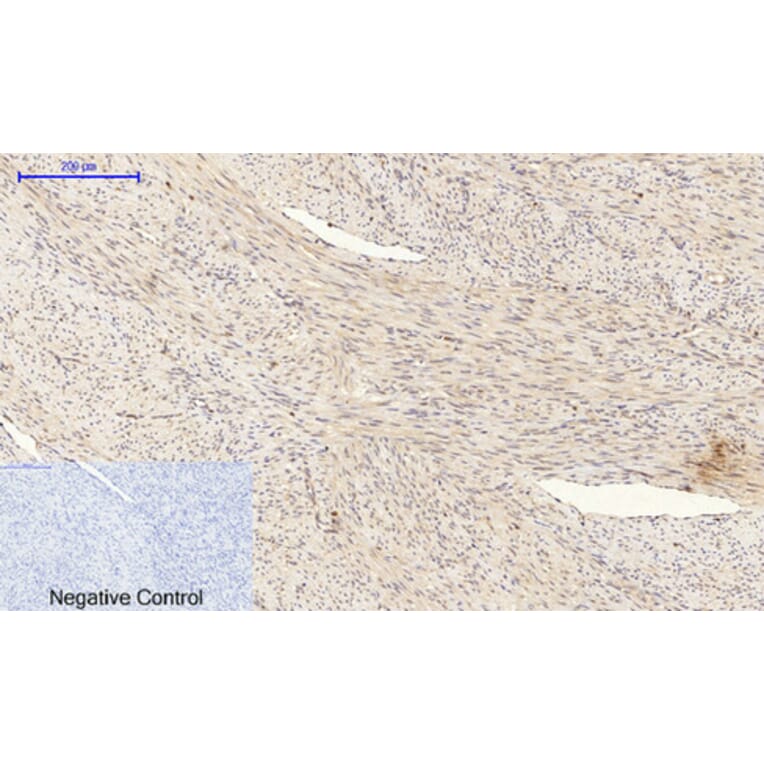 Immunohistochemistry - Anti-BAD Antibody (B0822) - Antibodies.com