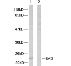 Western Blot - Anti-BAD Antibody (B7020) - Antibodies.com