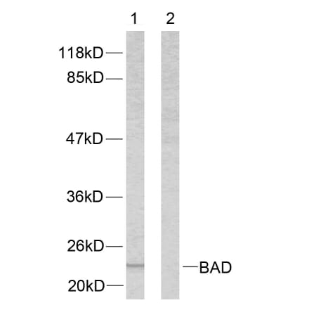 Western Blot - Anti-BAD Antibody (B7020) - Antibodies.com
