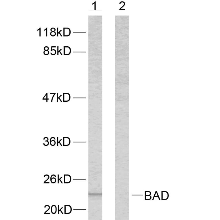 Western Blot - Anti-BAD Antibody (B7020) - Antibodies.com