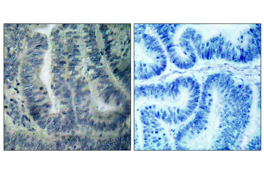 Immunohistochemistry - Anti-BAD Antibody (B7020) - Antibodies.com