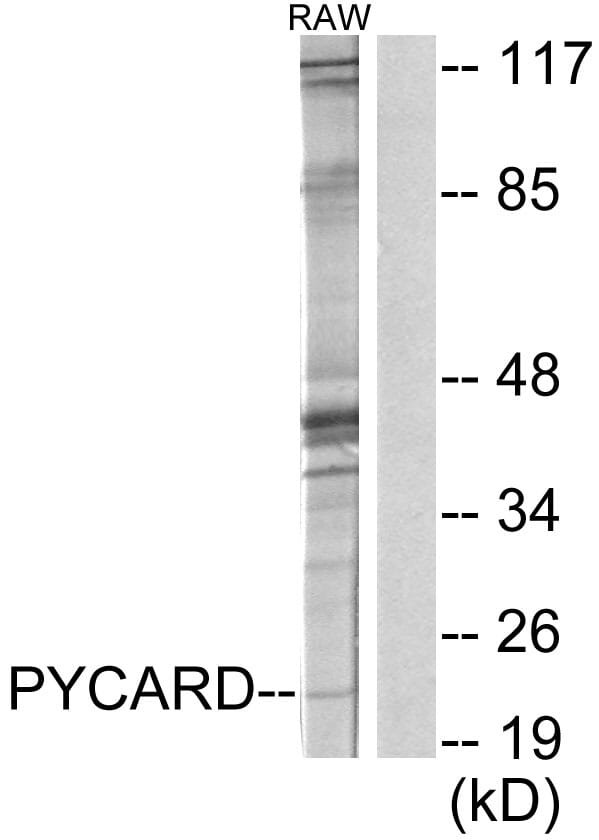 Western blot analysis of lysates from RAW264.7 cells using Anti-ASC Antibody. The right hand lane represents a negative control, where the antibody is blocked by the immunising peptide.