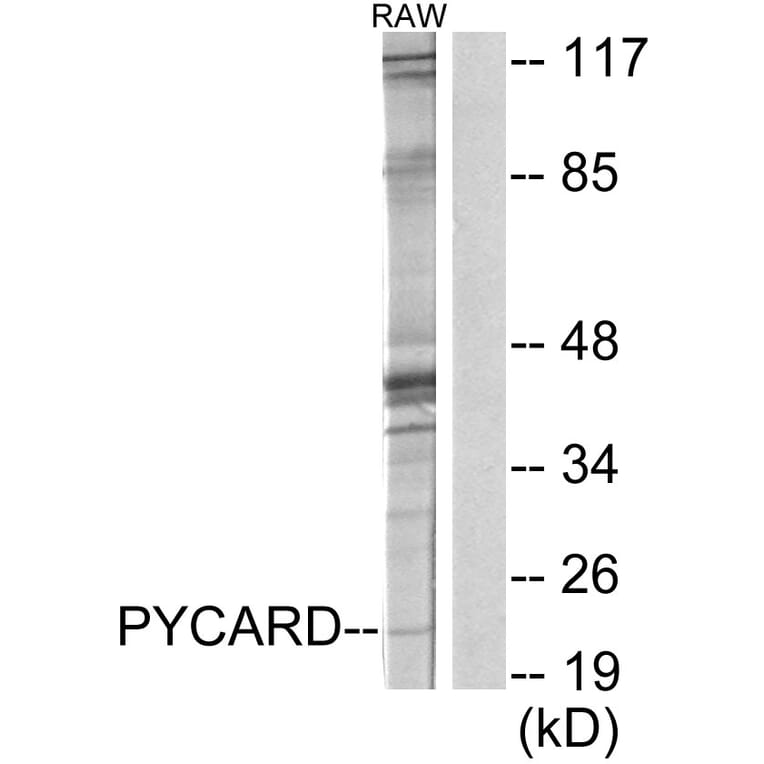 Western Blot - Anti-ASC Antibody (C11888) - Antibodies.com
