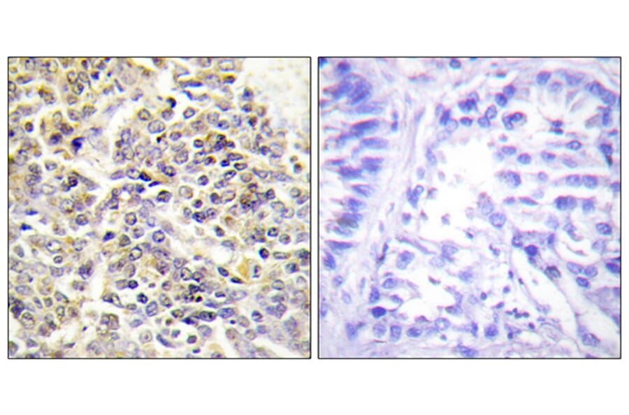 Immunohistochemistry - Anti-ASC Antibody (C11888) - Antibodies.com