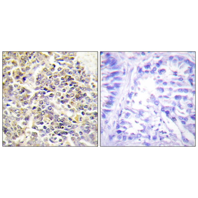 Immunohistochemistry - Anti-ASC Antibody (C11888) - Antibodies.com