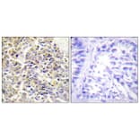 Immunohistochemistry - Anti-ASC Antibody (C11888) - Antibodies.com