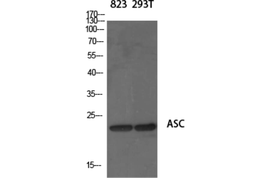 Western Blot - Anti-ASC Antibody (C11888) - Antibodies.com