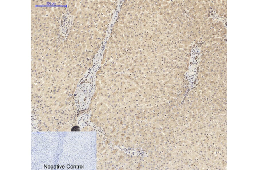 Immunohistochemistry - Anti-ASC Antibody (C11888) - Antibodies.com