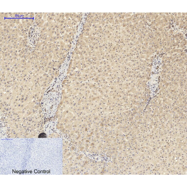 Immunohistochemistry - Anti-ASC Antibody (C11888) - Antibodies.com