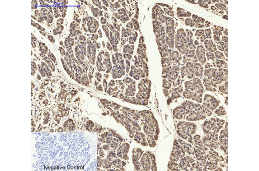 Immunohistochemistry - Anti-ASC Antibody (C11888) - Antibodies.com