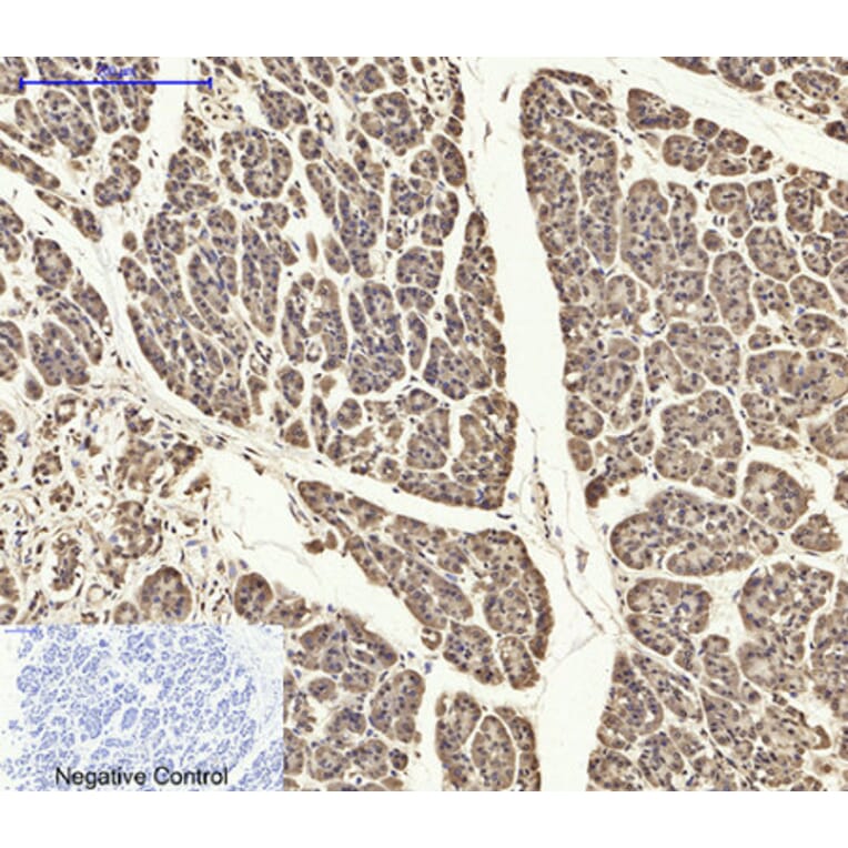 Immunohistochemistry - Anti-ASC Antibody (C11888) - Antibodies.com