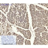 Immunohistochemistry - Anti-ASC Antibody (C11888) - Antibodies.com