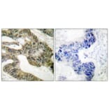 Immunohistochemistry - Anti-APC Antibody (C0129) - Antibodies.com