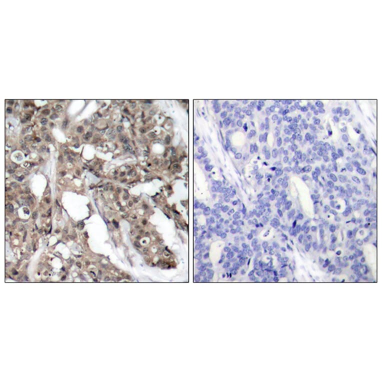 Immunohistochemistry - Anti-Akt Antibody (B7005) - Antibodies.com
