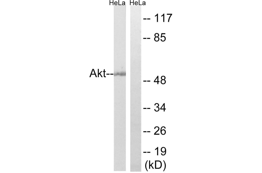 Western Blot - Anti-Akt Antibody (B7004) - Antibodies.com
