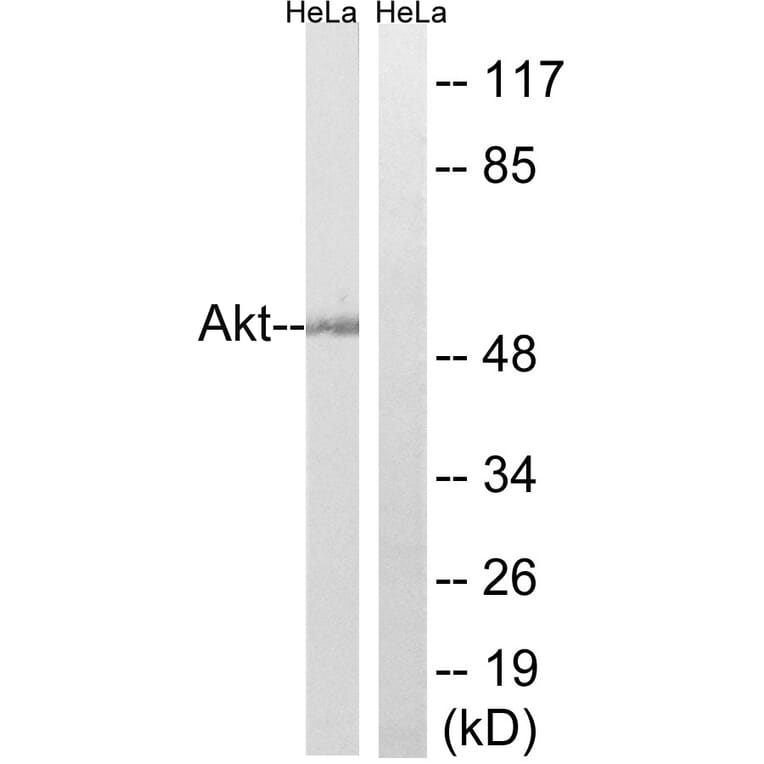 Western Blot - Anti-Akt Antibody (B7004) - Antibodies.com