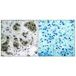 Immunohistochemistry - Anti-Akt Antibody (B7004) - Antibodies.com