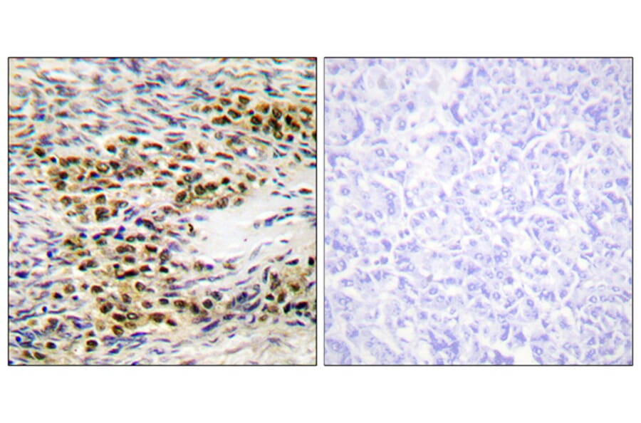 Immunohistochemistry - Anti-Akt Antibody (B0608) - Antibodies.com