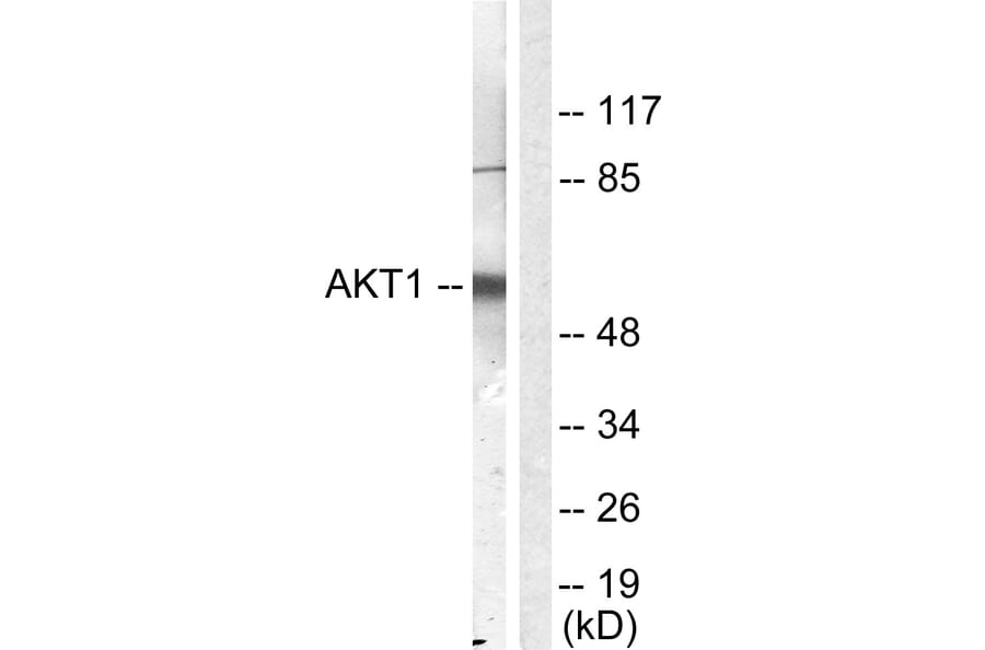 Western Blot - Anti-Akt Antibody (B0406) - Antibodies.com