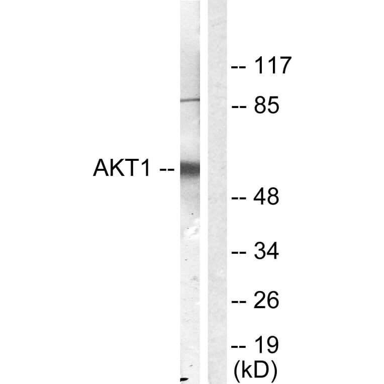 Western Blot - Anti-Akt Antibody (B0406) - Antibodies.com