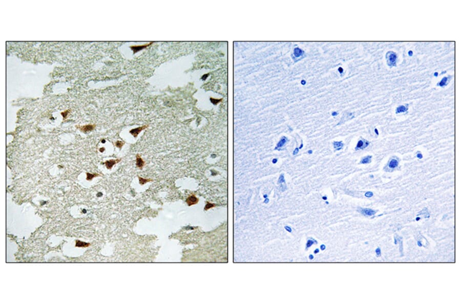 Immunohistochemistry - Anti-Akt Antibody (B0406) - Antibodies.com