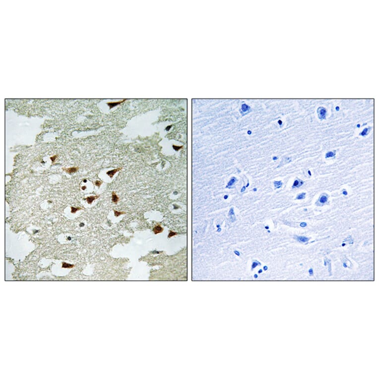 Immunohistochemistry - Anti-Akt Antibody (B0406) - Antibodies.com