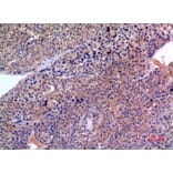 Immunohistochemistry - Anti-SERPINB3 + SERPINB4 Antibody (C30744) - Antibodies.com