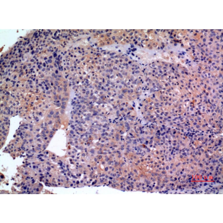 Immunohistochemistry - Anti-SERPINB3 + SERPINB4 Antibody (C30744) - Antibodies.com