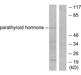 Western Blot - Anti-Parathyroid Hormone Antibody (C0293) - Antibodies.com
