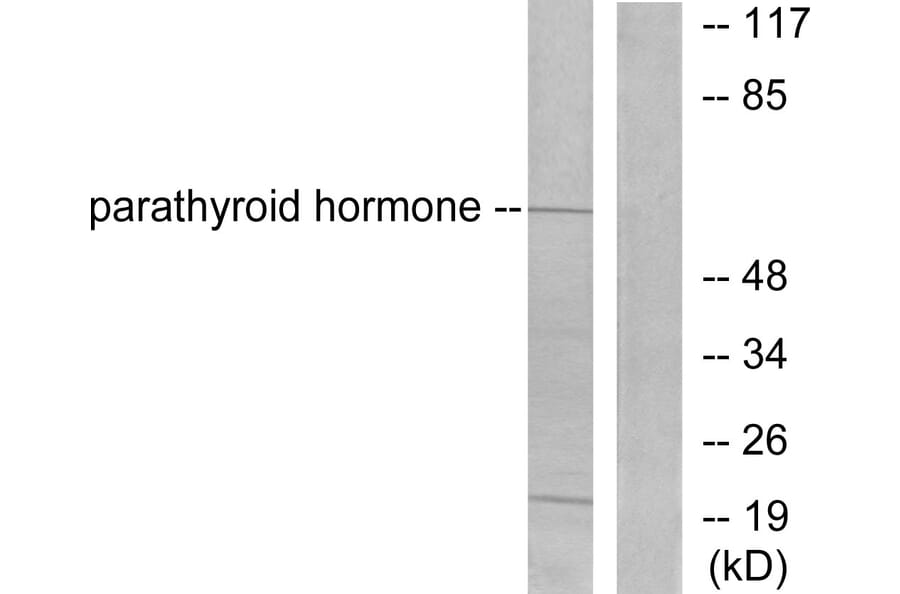 Western Blot - Anti-Parathyroid Hormone Antibody (C0293) - Antibodies.com