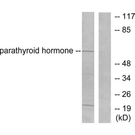 Western Blot - Anti-Parathyroid Hormone Antibody (C0293) - Antibodies.com