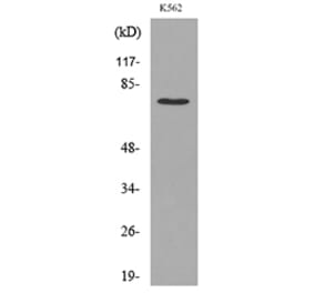 Western Blot - Anti-p73 (acetyl Lys321) Antibody (D12176) - Antibodies.com