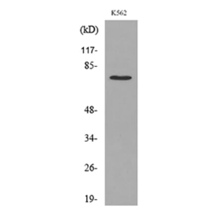 Western Blot - Anti-p73 (acetyl Lys321) Antibody (D12176) - Antibodies.com
