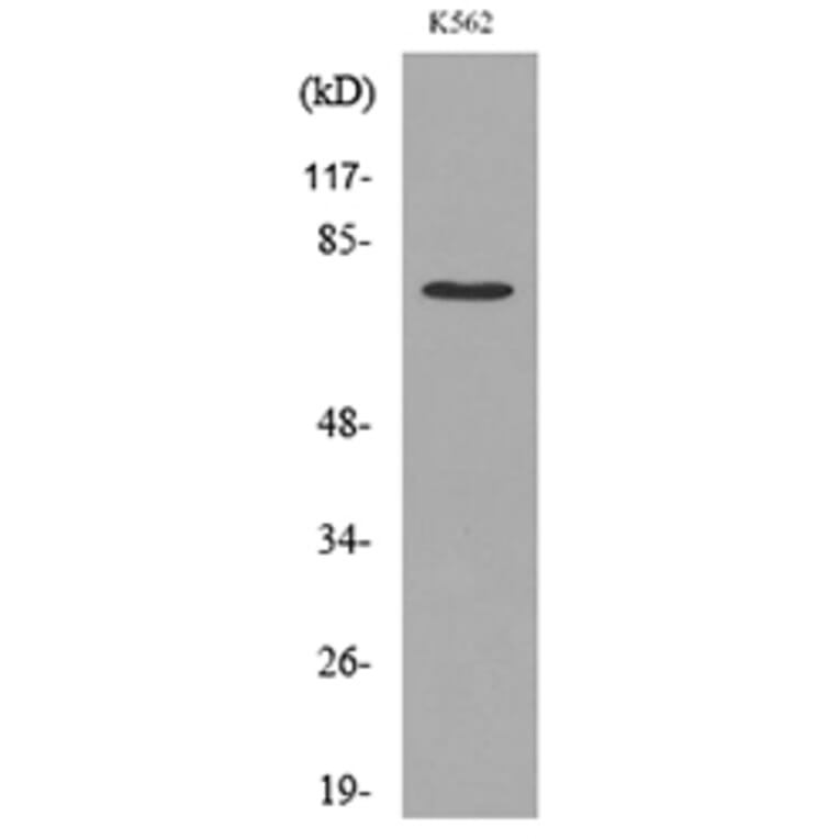 Western Blot - Anti-p73 (acetyl Lys321) Antibody (D12176) - Antibodies.com