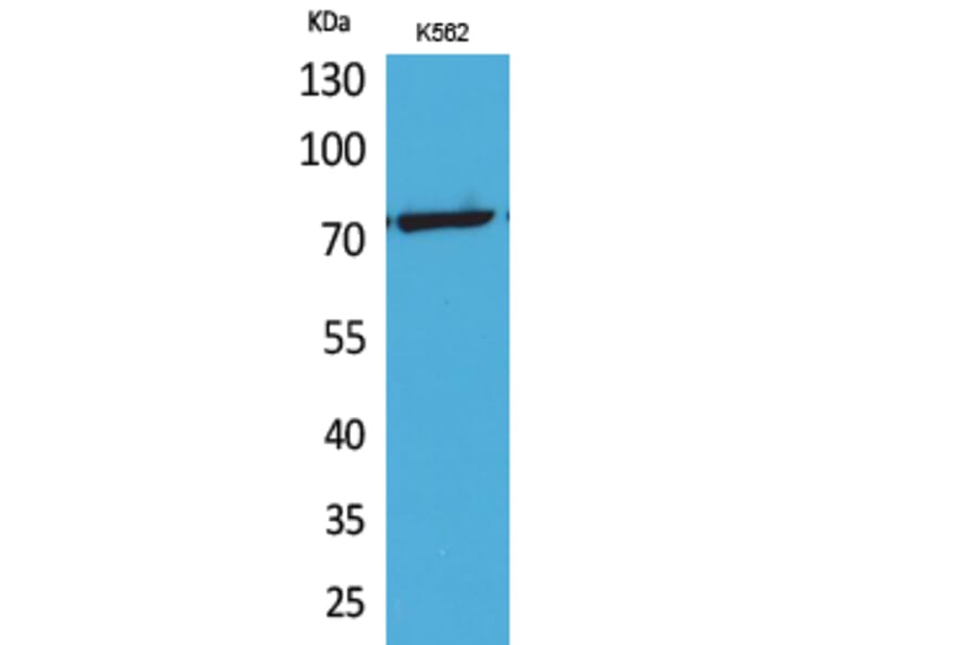 Western Blot - Anti-p73 (acetyl Lys321) Antibody (D12176) - Antibodies.com