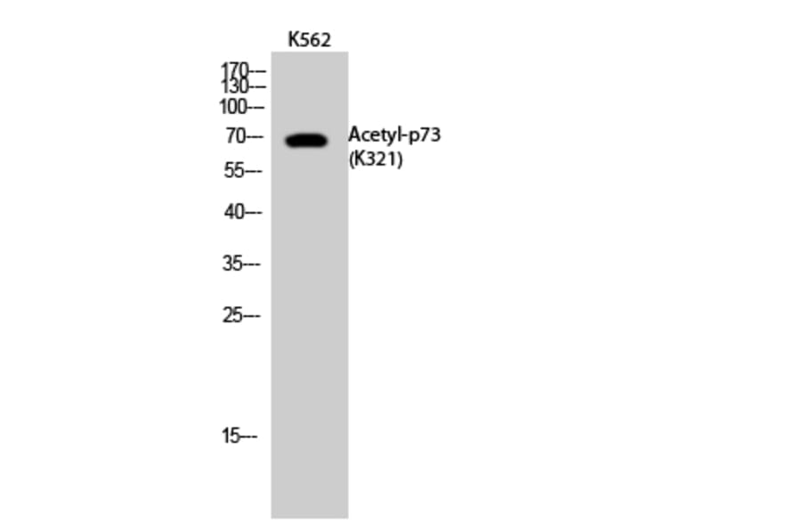 Western Blot - Anti-p73 (acetyl Lys321) Antibody (D12176) - Antibodies.com