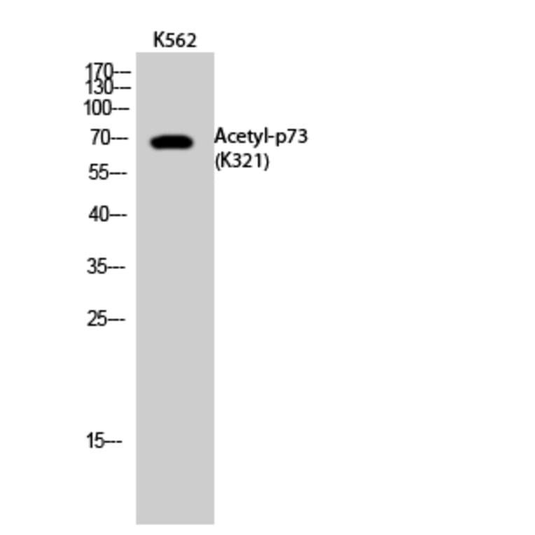 Western Blot - Anti-p73 (acetyl Lys321) Antibody (D12176) - Antibodies.com