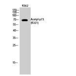 Western Blot - Anti-p73 (acetyl Lys321) Antibody (D12176) - Antibodies.com