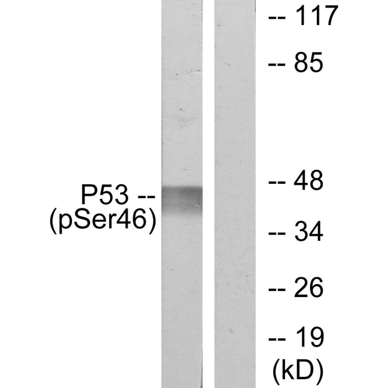 Western Blot - Anti-p53 (phospho Ser46) Antibody (A7184) - Antibodies.com