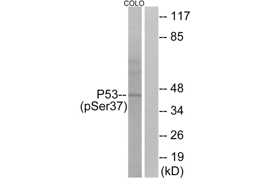 Western Blot - Anti-p53 (phospho Ser37) Antibody (A7183) - Antibodies.com