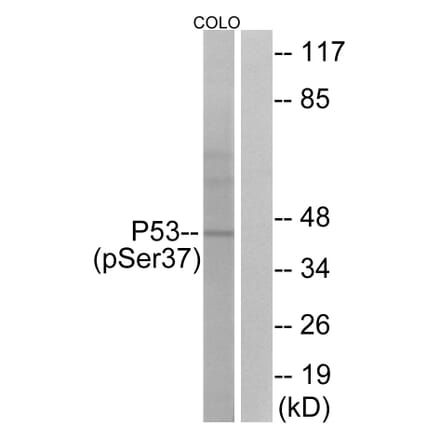 Western Blot - Anti-p53 (phospho Ser37) Antibody (A7183) - Antibodies.com
