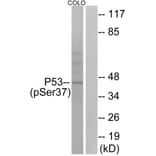 Western Blot - Anti-p53 (phospho Ser37) Antibody (A7183) - Antibodies.com