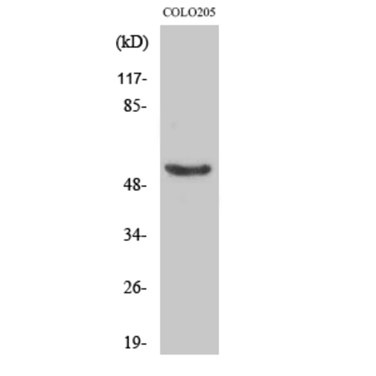 Western Blot - Anti-p53 (phospho Ser37) Antibody (A7183) - Antibodies.com