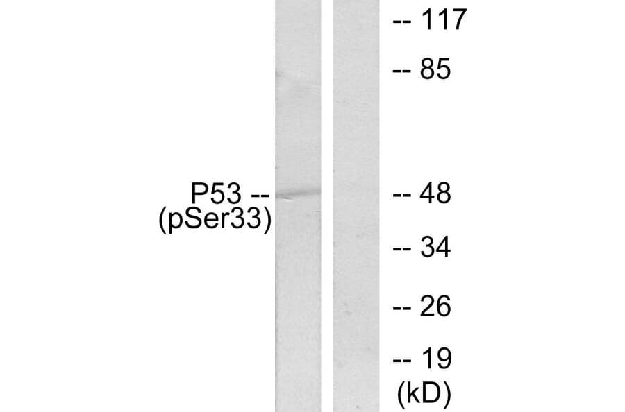 Western Blot - Anti-p53 (phospho Ser33) Antibody (A7182) - Antibodies.com