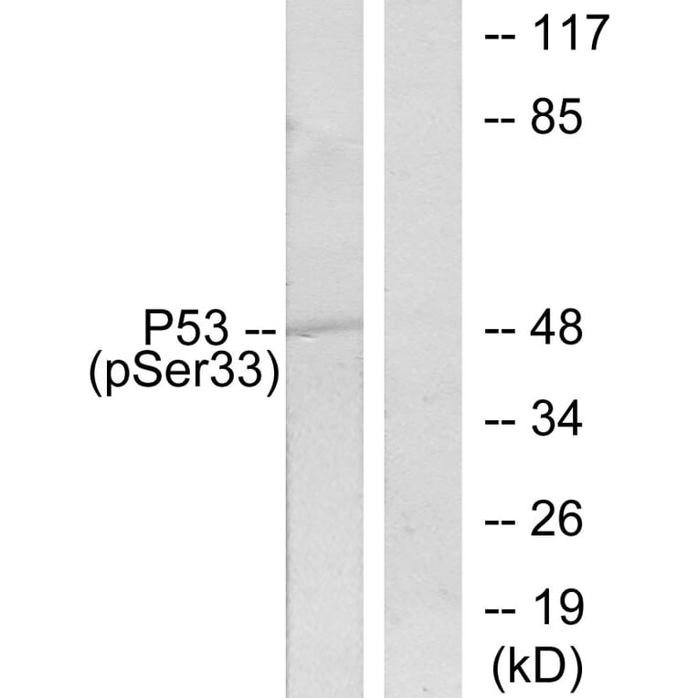 Western Blot - Anti-p53 (phospho Ser33) Antibody (A7182) - Antibodies.com